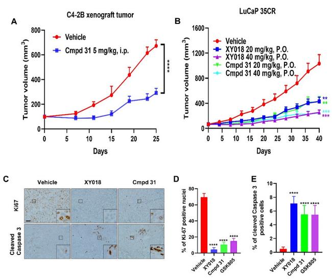 Ki-67 Antibody in Immunohistochemistry (IHC)