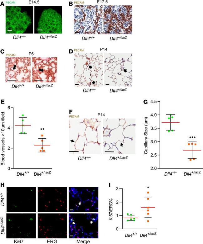 Ki-67 Antibody in Immunohistochemistry (IHC)