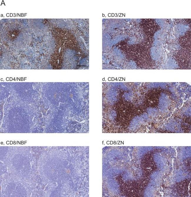 FOXP3 Antibody in Immunohistochemistry (IHC)