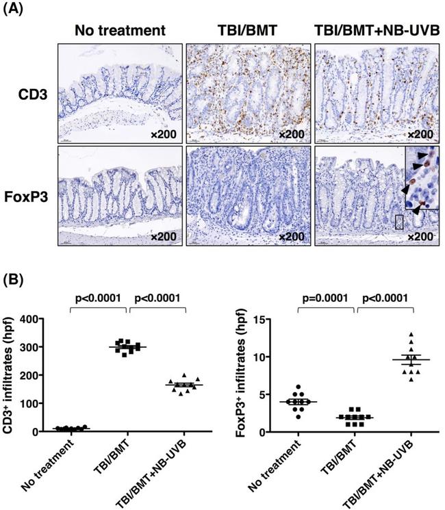 FOXP3 Antibody in Immunohistochemistry (IHC)