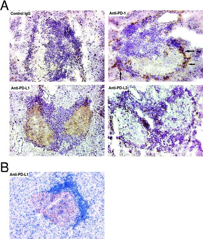 CD279 (PD-1) Antibody in Immunohistochemistry (IHC)