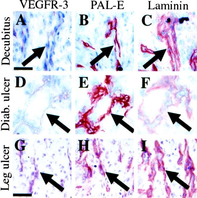 VEGF Receptor 3 Antibody in Immunohistochemistry (IHC)