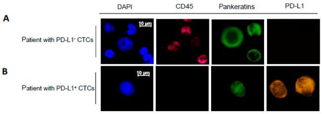 Pan Cytokeratin Antibody in Immunocytochemistry (ICC/IF)