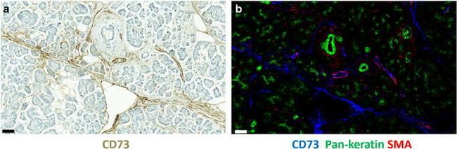 Pan Cytokeratin Antibody in Immunohistochemistry (IHC)