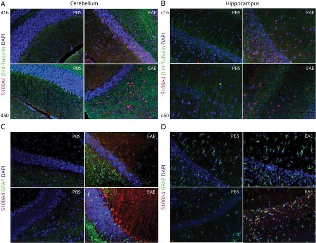 GFAP Antibody in Immunohistochemistry (Frozen) (IHC (F))