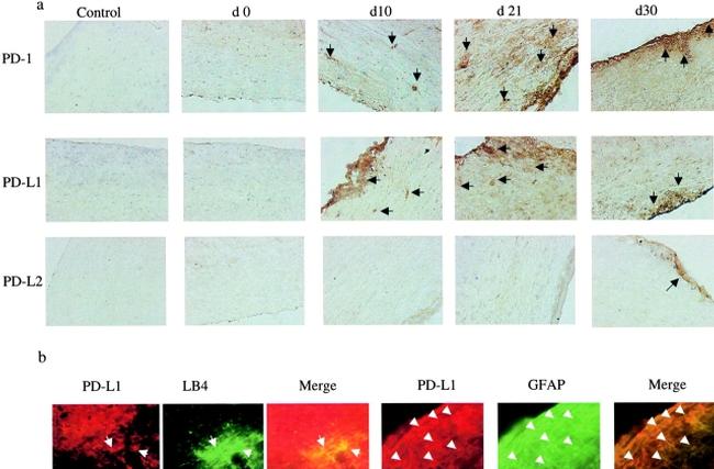 CD279 (PD-1) Antibody in Immunohistochemistry (IHC)