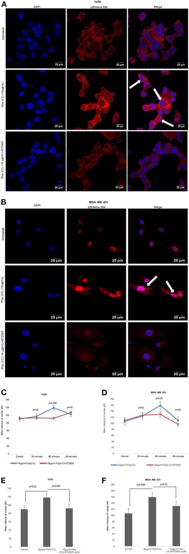 NFkB p65 Antibody in Immunocytochemistry (ICC/IF)