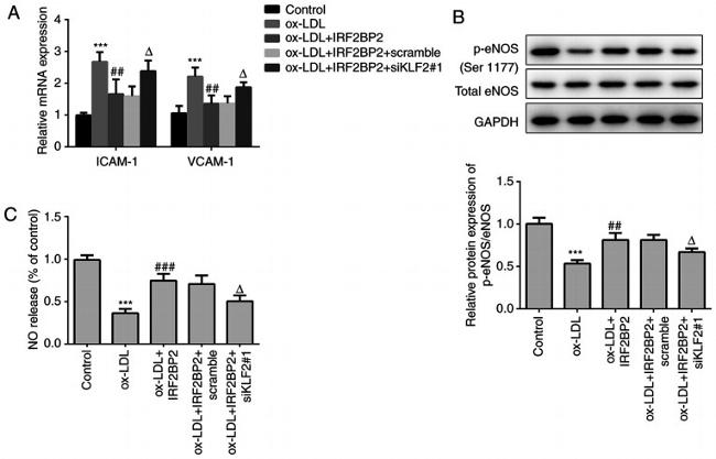 Phospho-eNOS (Ser1177) Antibody in Western Blot (WB)