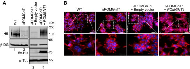 Penta-His Tag Antibody in Western Blot (WB)