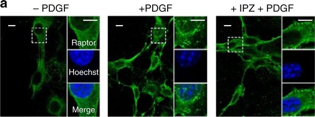 Rat IgG (H+L) Cross-Adsorbed Secondary Antibody in Immunocytochemistry (ICC/IF)