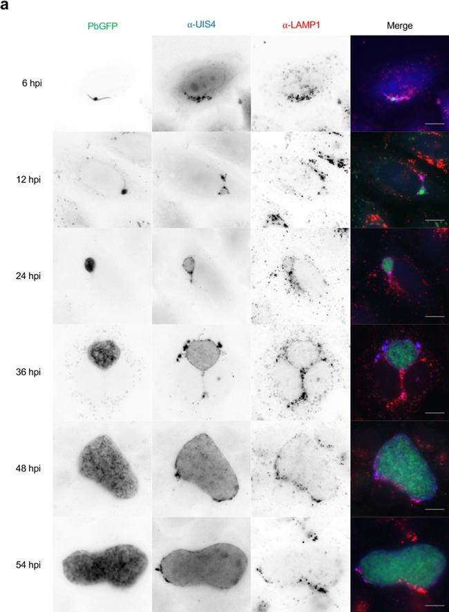 Mouse IgG (H+L) Highly Cross-Adsorbed Secondary Antibody in Immunocytochemistry (ICC/IF)