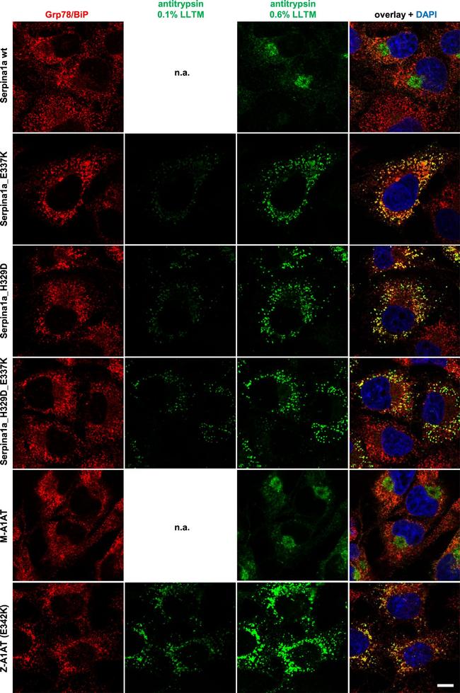 Rabbit IgG (H+L) Highly Cross-Adsorbed Secondary Antibody in Immunocytochemistry (ICC/IF)