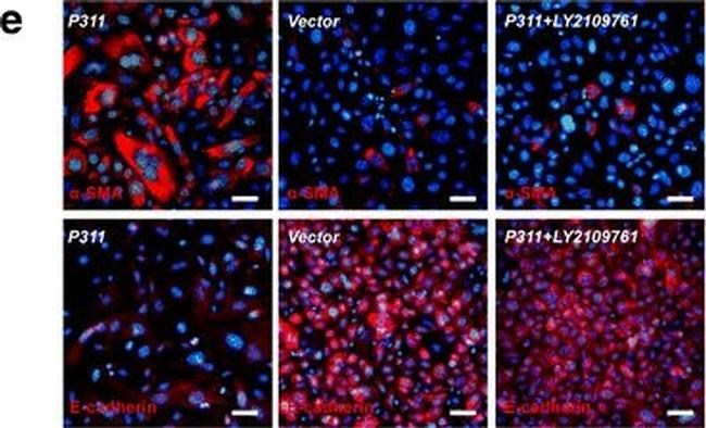 Rabbit IgG (H+L) Highly Cross-Adsorbed Secondary Antibody in Immunocytochemistry (ICC/IF)