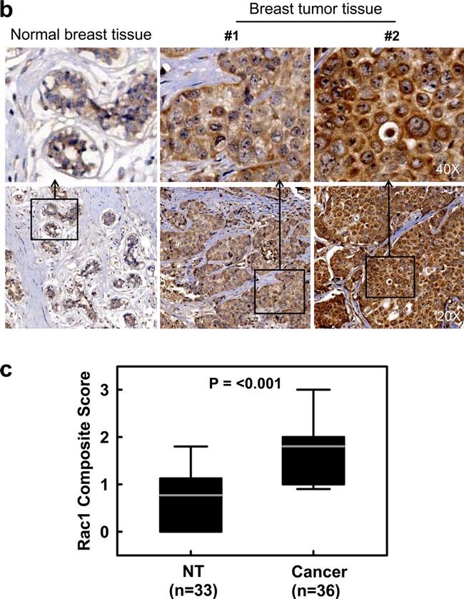 RAC1 Antibody