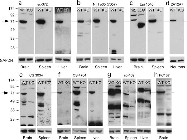 NFkB p65 Antibody