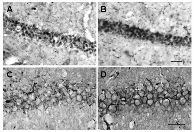 Glucocorticoid Receptor Antibody in Immunocytochemistry, Immunohistochemistry (ICC/IF, IHC)