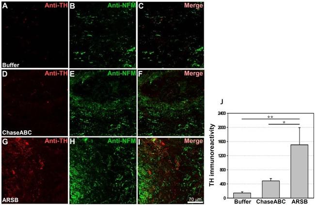 NEFM Antibody