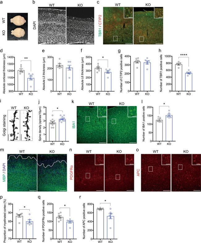 CD140a (PDGFRA) Antibody in Immunohistochemistry (IHC)