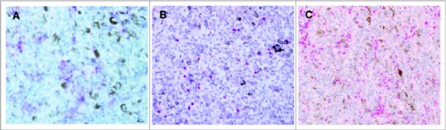 FOXP3 Antibody in Immunohistochemistry (IHC)