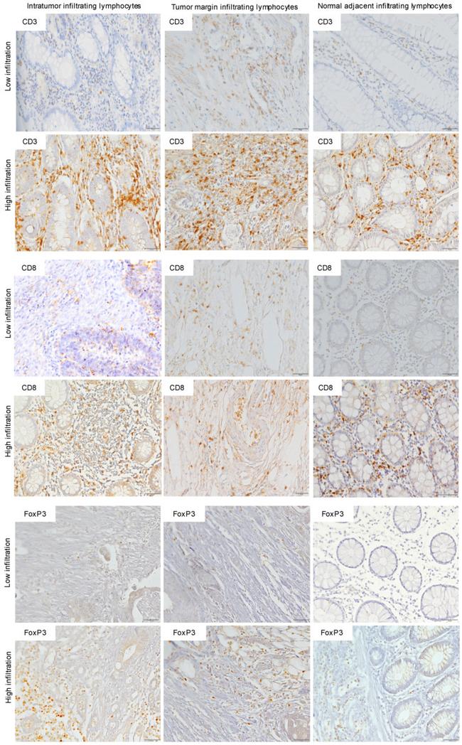 FOXP3 Antibody in Immunohistochemistry (IHC)