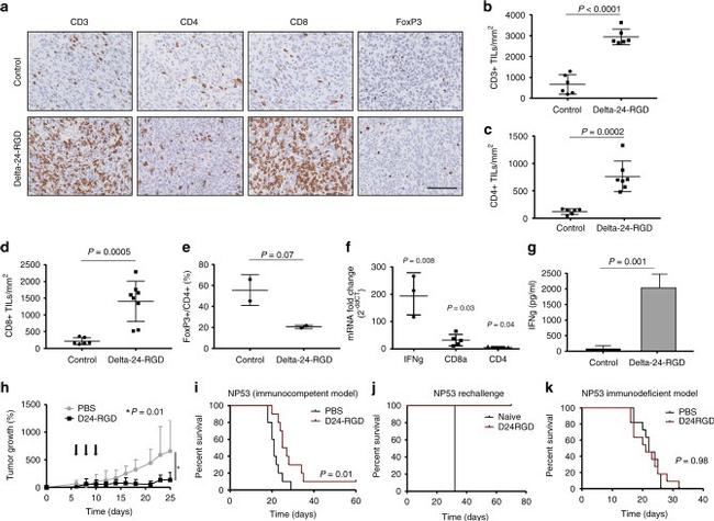 FOXP3 Antibody in Immunohistochemistry (IHC)