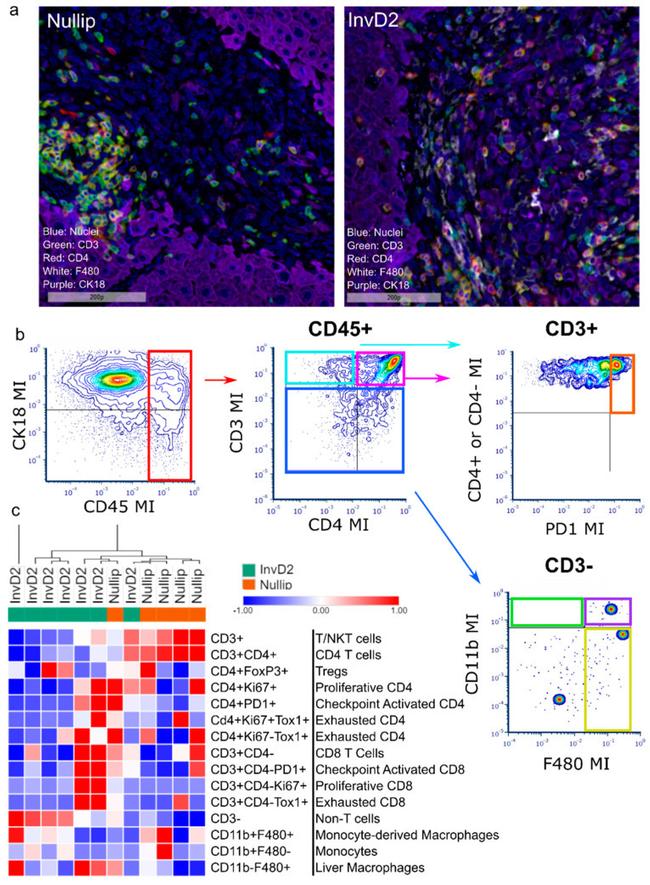 FOXP3 Antibody in Immunohistochemistry (IHC)