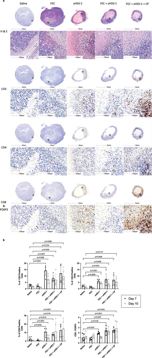 FOXP3 Antibody in Immunohistochemistry (IHC)