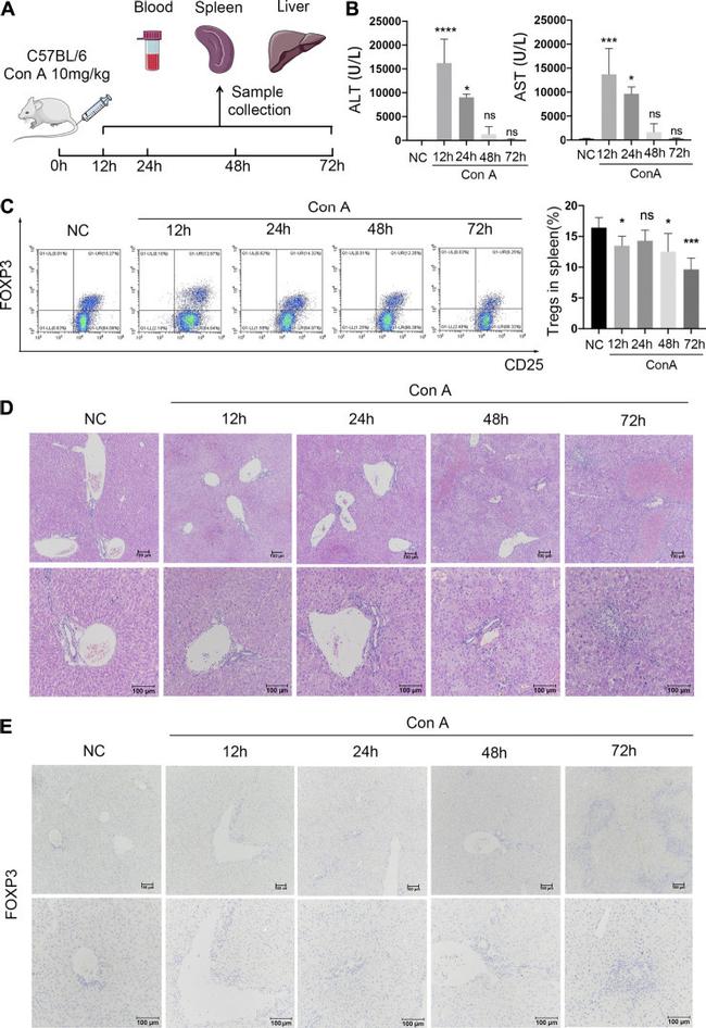 FOXP3 Antibody in Immunohistochemistry (IHC)