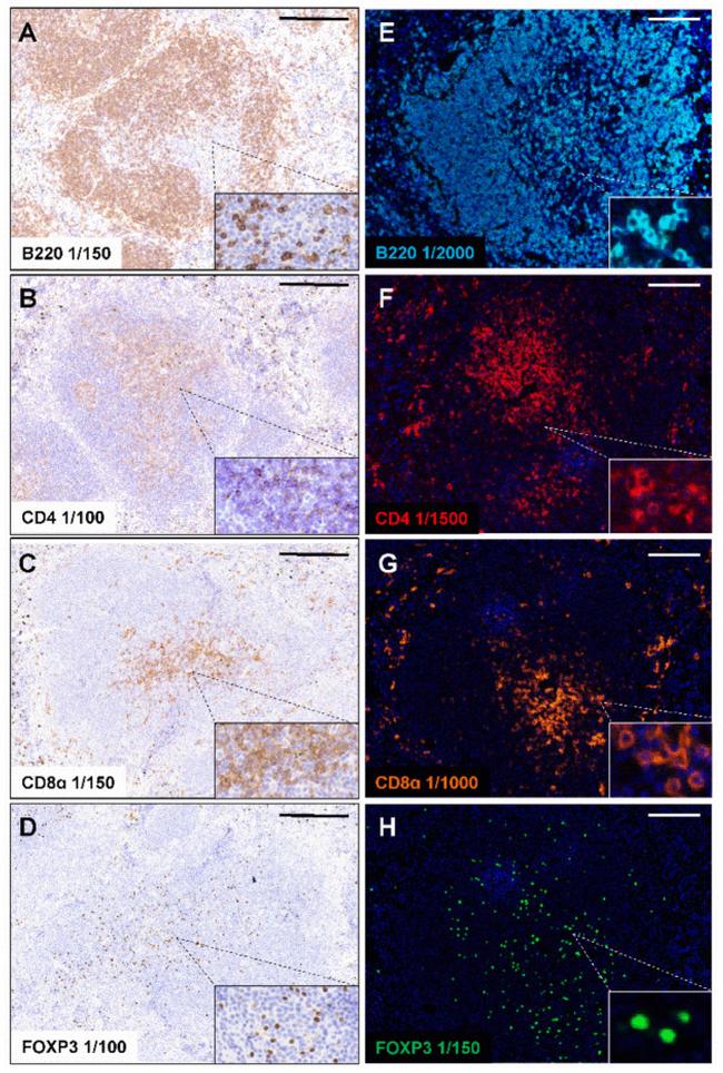 FOXP3 Antibody in Immunohistochemistry (IHC)