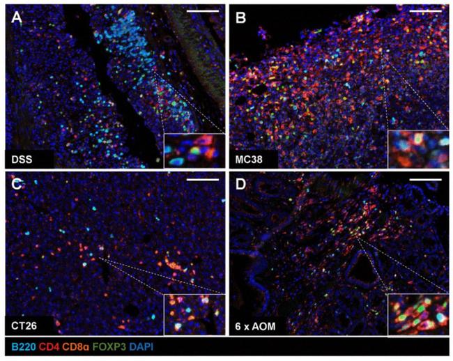 FOXP3 Antibody in Immunohistochemistry (IHC)