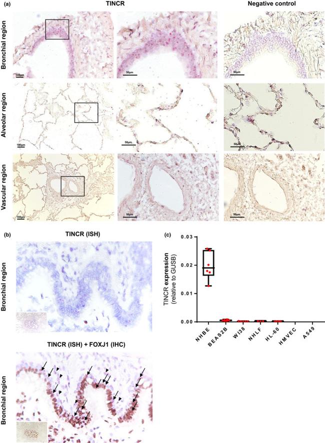 FOXJ1 Antibody in Immunohistochemistry (IHC)