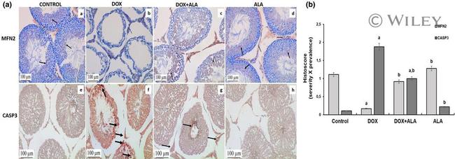 Caspase 3 Antibody in Immunohistochemistry (IHC)