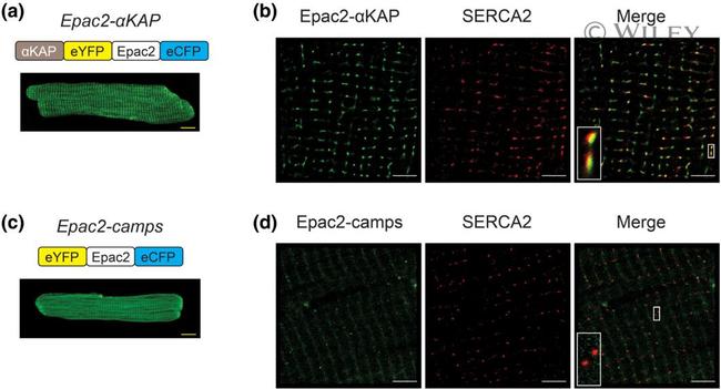 SERCA2 ATPase Antibody in Immunocytochemistry (ICC/IF)