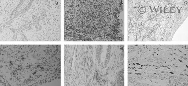 CD34 Antibody in Immunohistochemistry (IHC)