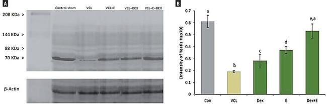 HSP70 Antibody in Western Blot (WB)