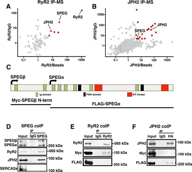 SERCA2 ATPase Antibody in Immunoprecipitation (IP)