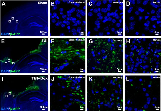 beta Amyloid Antibody in Immunohistochemistry (IHC)