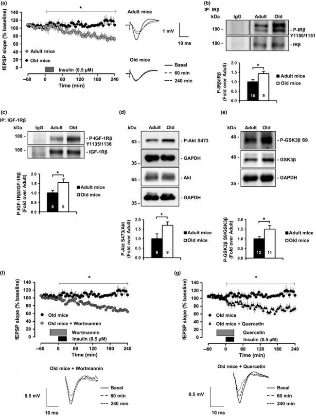 GSK3 alpha/beta Antibody in Western Blot (WB)