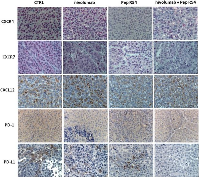 PD-1 Antibody in Immunohistochemistry (Paraffin) (IHC (P))