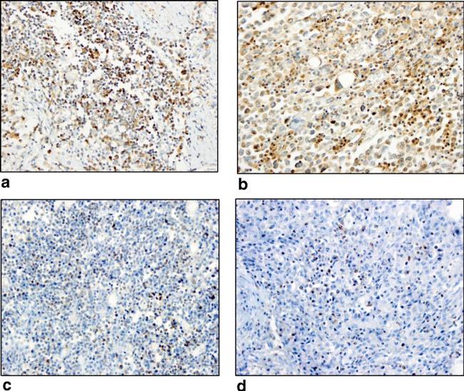 CTLA-4 Antibody in Immunohistochemistry (IHC)