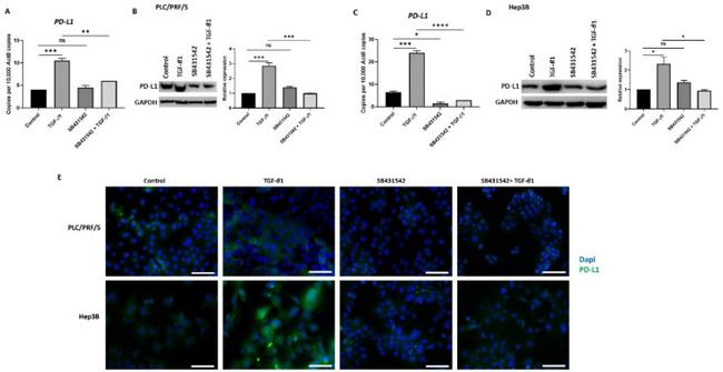 TGF beta-1 Antibody in Immunocytochemistry (ICC/IF)