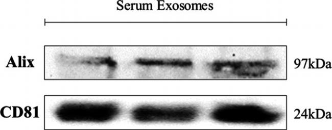 CD81 Antibody in Western Blot (WB)