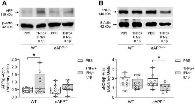 beta Amyloid Antibody in Western Blot (WB)