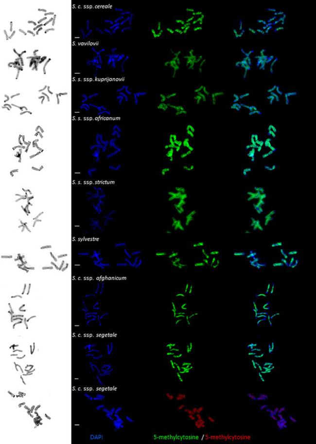 5-Methylcytosine Antibody in Immunocytochemistry (ICC/IF)