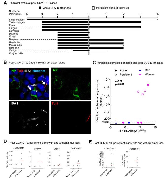 beta-3 Tubulin Antibody in Immunocytochemistry (ICC/IF)