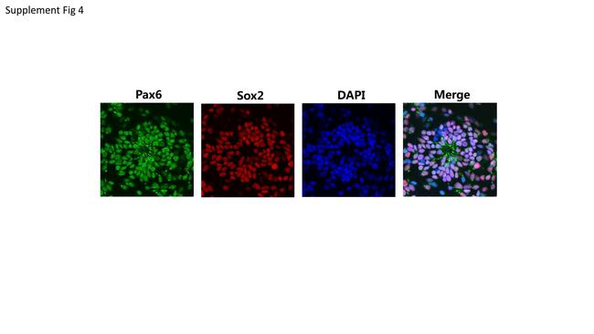 PAX6 Antibody in Immunocytochemistry (ICC/IF)