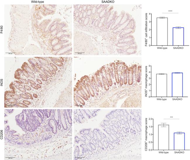 iNOS Antibody in Immunohistochemistry (IHC)