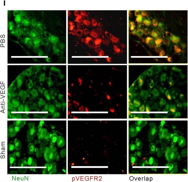 Mouse IgG (H+L) Highly Cross-Adsorbed Secondary Antibody in Immunohistochemistry (Paraffin) (IHC (P))