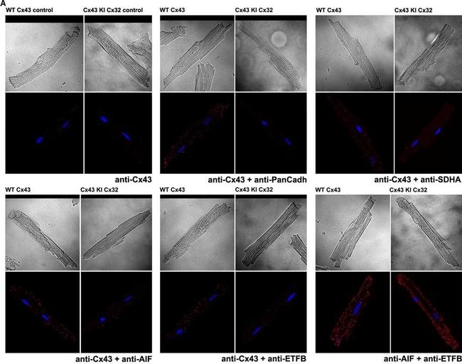 Rabbit IgG (H+L) Cross-Adsorbed Secondary Antibody in Immunocytochemistry (ICC/IF)