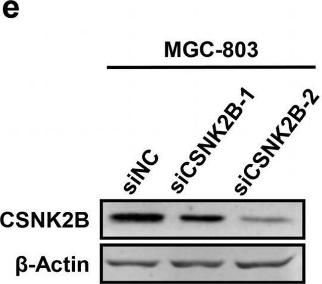 Rabbit IgG (H+L) Secondary Antibody in Western Blot (WB)